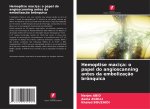 Hemoptise maciça: o papel do angioscanning antes da embolização brônquica