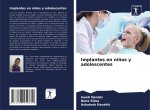 Implantes en niños y adolescentes