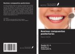 Resinas compuestas posteriores