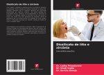 Dissilicato de lítio e zircônia