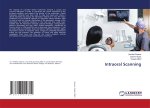 Intraoral Scanning