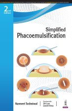 Simplified Phacoemulsification
