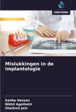 Mislukkingen in de implantologie