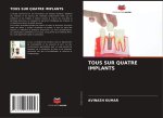 TOUS SUR QUATRE IMPLANTS