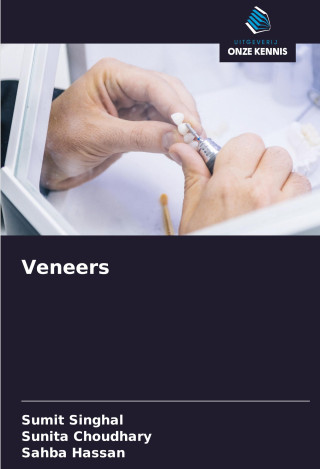 Veneers