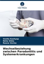 Wechselbeziehung zwischen Parodontitis und Systemerkrankungen