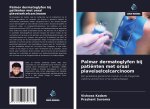 Palmar dermatoglyfen bij patiënten met oraal plaveiselcelcarcinoom