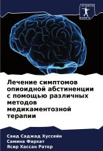 Lechenie simptomow opioidnoj abstinencii s pomosch'ü razlichnyh metodow medikamentoznoj terapii