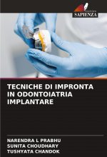 TECNICHE DI IMPRONTA IN ODONTOIATRIA IMPLANTARE