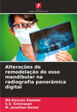 Alteraç?es de remodelaç?o do osso mandibular na radiografia panorâmica digital