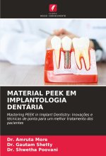 MATERIAL PEEK EM IMPLANTOLOGIA DENTÁRIA