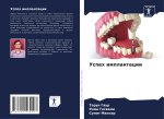 Uspeh implantacii