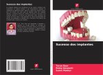 Sucesso dos implantes