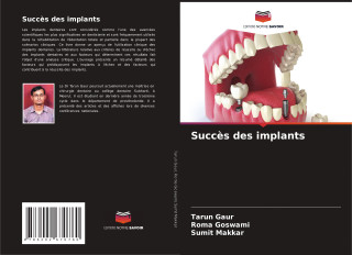 Succès des implants