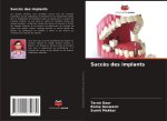 Succès des implants