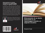Rilevamento di un dente mancante in un ingranaggio tramite un segnale acustico