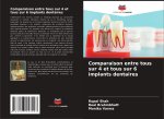 Comparaison entre tous sur 4 et tous sur 6 implants dentaires