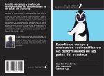 Estudio de campo y evaluación radiográfica de las deformidades de las patas del avestruz