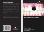 Fallimenti implantari