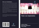 Falen van implantaten