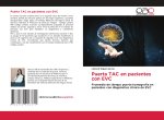 Puerta TAC en pacientes con EVC