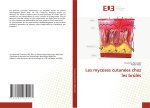 Les mycoses cutanées chez les br?lés
