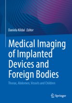 Medical Imaging of Implanted Devices and Foreign Bodies