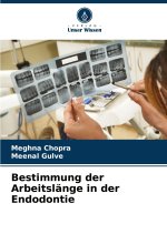 Bestimmung der Arbeitslänge in der Endodontie