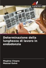 Determinazione della lunghezza di lavoro in endodonzia