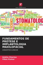 FUNDAMENTOS DE PRÓTESE E IMPLANTOLOGIA MAXILOFACIAL
