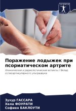 Porazhenie lodyzhek pri psoriaticheskom artrite