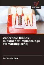 Znaczenie tkanek mi?kkich w implantologii stomatologicznej