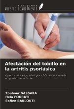 Afectación del tobillo en la artritis psoriásica