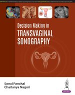 Decision Making in Transvaginal Sonography
