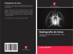 Radiografia do tórax