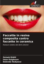 Faccette in resina composita contro faccette in ceramica