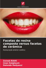Facetas de resina composta versus facetas de cerâmica
