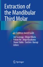Extraction of the Mandibular Third Molar