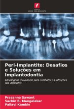 Peri-Implantite: Desafios e Soluç?es em Implantodontia