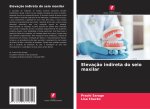 Elevaç?o indireta do seio maxilar