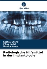 Radiologische Hilfsmittel in der Implantologie