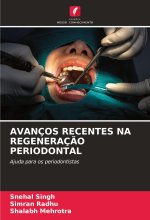 AVANÇOS RECENTES NA REGENERAÇ?O PERIODONTAL
