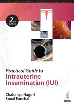 Practical Guide to Intrauterine Insemination (IUI)