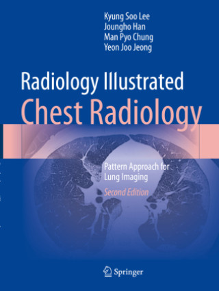 Radiology Illustrated: Chest Radiology (Kyung Soo Lee,Joungho Han,Man Pyo Chung,Yeon Joo Jeong)(Puha kötésű)