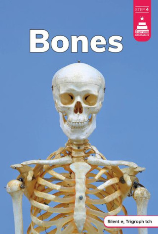 Bones