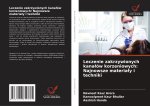 Leczenie zakrzywionych kana?ów korzeniowych: Najnowsze materia?y i techniki
