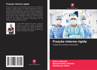 Fixaç?o interna rígida