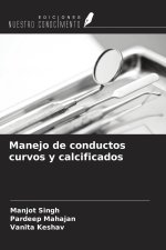 Manejo de conductos curvos y calcificados