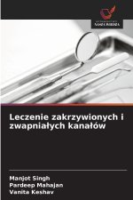 Leczenie zakrzywionych i zwapnia?ych kana?ów