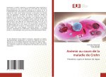 Anémie au cours de la maladie de Crohn
